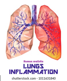Low poly realistic human lungs and bronchus with cancer inflammation disease. Smoker's lungs. Vector.