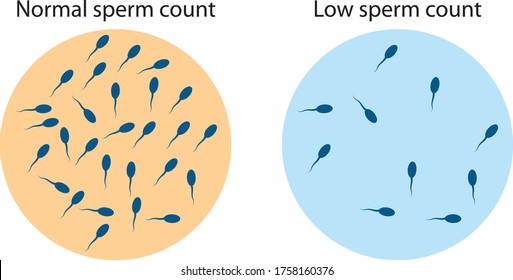 Slow Sperm