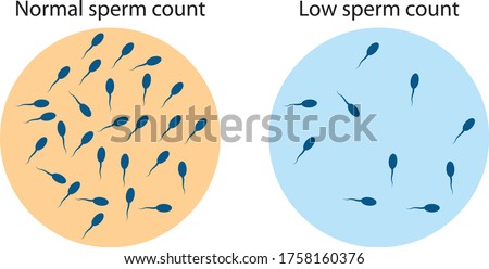 Low sperm count in seminal fluid. Male infertility oligospermia. Structure of the sperm. Vector. Stock photo © 