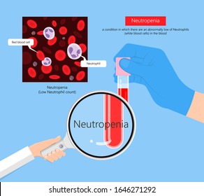 Low White Blood Cell Count Leukopenia Diagnostic Fight Sepsis Virus Bone Marrow Aplastic Anemia Illness Check Destroy Bacteria