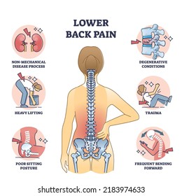 El dolor de espalda inferior y el esqueleto de la espina dorsal doloroso causan un diagrama esquelético. Plan educativo etiquetado con explicación del estado médico después del proceso de enfermedad o del vector de postura sentada