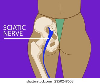 Lower back. Sciatic nerve. Anatomical illustration. Healthcare illustration. Vector illustration. 