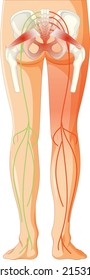 Lower back suffering from ankylosing spondylitis illustration