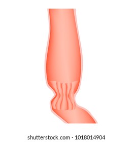 Lower Cardiac Esophageal Sphincter. Infographics. Vector Illustration On Isolated Background.