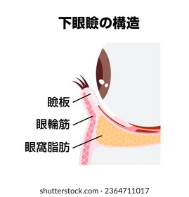 Ilustración vectorial de estructura del párpado inferior. Traducción: párpado inferior, placa de Tarsal, Orbicularis oculi, grasa orbital