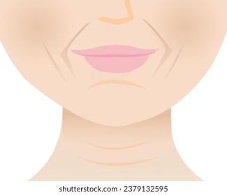 The lower face wrinkled skin of mature woman vector illustration. Marionette lines, Nasolabial folds, Smile lines, Mental crease and Neck lines. Deep aging wrinkles on face. Skin problem concept.