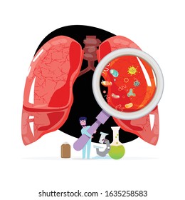 lower respiratory infection. vector illustration.