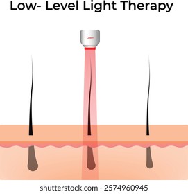 Low-Level Light Therapy for Hair Growth Design Vector Illustration