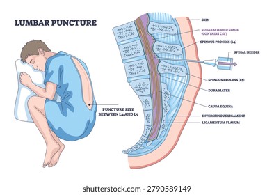 Lumbar puncture brief diagram shows curled patient and spinal needle entering L4 L5 for CSF access, highlighting vertebrae, key objects, patient, needle, vertebrae. Outline diagram