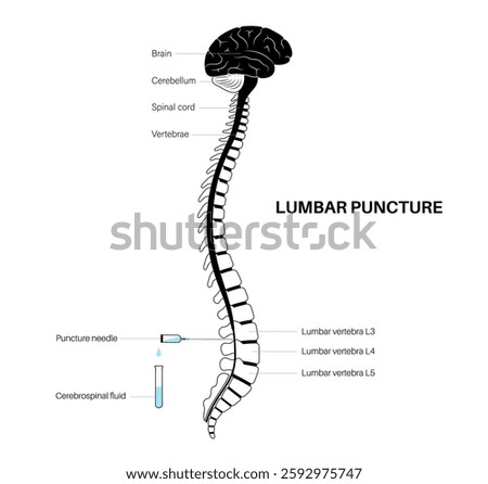 Lumbar puncture medical procedure. Spinal tap, cerebrospinal fluid collection concept. Inserted puncture needle into the space between two lumbar bones of the human spine, brain and spinal cord vector