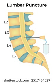 Diagrama de Ilustración vectorial de diseño de Ciencia de punción lumbar