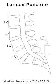 Diagrama de Ilustración vectorial de diseño de Ciencia de punción lumbar