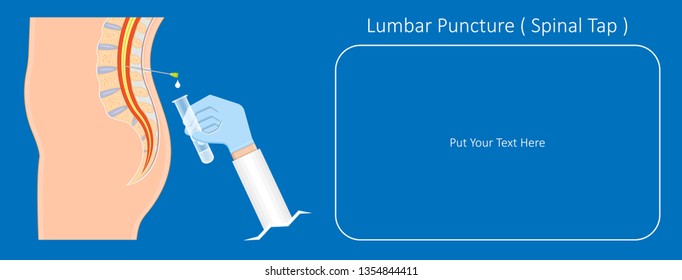 Lumbar Puncture Spinal Tap Canal Diagnostic Collect Sample Patient Treat MS Tumor Exam Drug Measure Pressure CSF Lab White Blood Cell