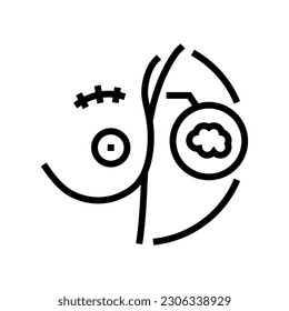 lumpectomy surgery line icon vector. lumpectomy surgery sign. isolated contour symbol black illustration