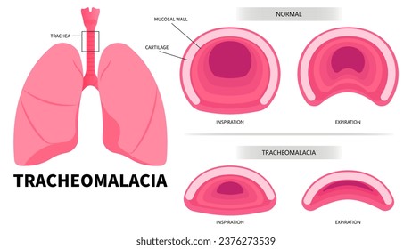 Lung anatomy with trachea exhalation inhalation breathe in common cold