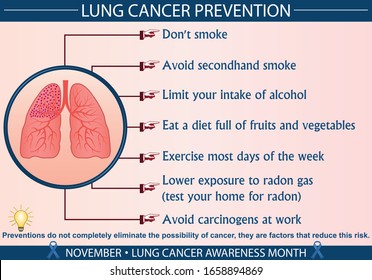 Lung Cancer Disease Prevention Infographic Vector Illustration. Protection, Treatment, Diagnosis, And Symptoms Concept. Flat Style Medical Template. Hand-drawn Awareness Month, And Health Design. 