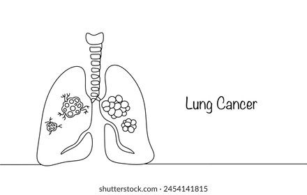 Cáncer de pulmón. Tumor maligno que se origina en el epitelio de los bronquios o los pulmones. Enfermedad del sistema respiratorio humano. Vector sencillo.