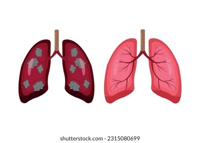 lung cancer and normal lung illustration comparation. eps 10. icon set