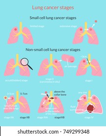 Lymph Nodes Images, Stock Photos & Vectors | Shutterstock