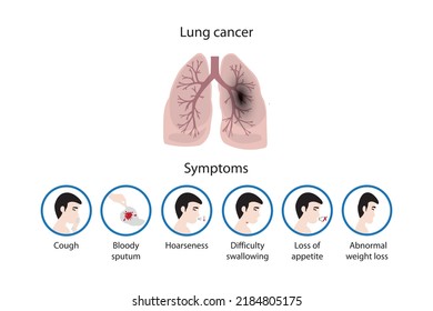 
Lung cancer and its symptoms