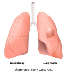 Human Lungs Cartoon Style Lungs Logo Stock Illustration 1818956027