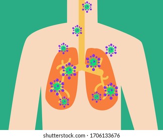 Lung with Corona virus (COVID-19) cartoon vector style for your design.