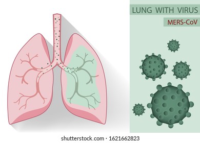 Lung design with virus graphic MERS CoV infographics concept