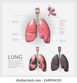 Lung with Detail and Lung Cancer Vector Illustration