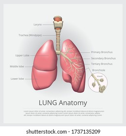 Vector Asthma Illustration Bronchial Lungs Respiratory Stock Vector ...