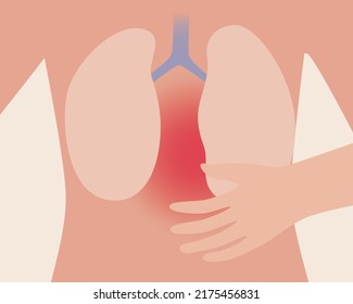 Lungenerkrankung. Anatomische Vektorgrafik. Person und Krankheit Bronchitis oder Pneumonie. Körperschmerzen