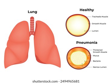 Lung Healthy Pneumonia Science Design Vector Illustration Diagram