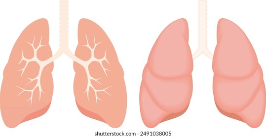 Lung image set 1
This set contains simple explanatory diagrams of the lungs.