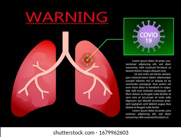 Lung Infection by Covid-19 virus, vector infographic