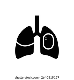 Lung opacity patch chest x-ray medical diagnostic image