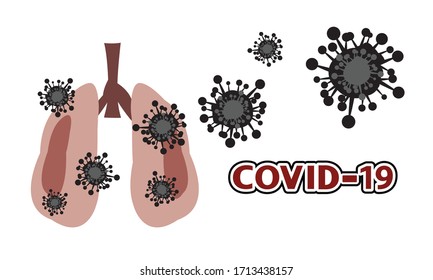 Pulmón con neumonía, neumonía por el coronavirus Novel (NCP). Enfermedad de 2019-nCoV.