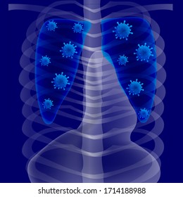 Lung X-ray human body background