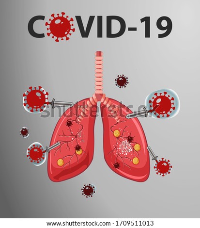 lungh attact by corona virus covid 19 2019