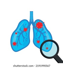 Lungs affected by cancer look through a magnifying glass.