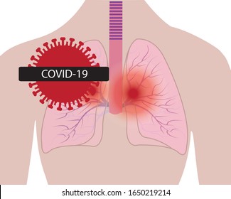 Lungs affected with coronavirus infection  COVID19 vector illustration isolated on a white background