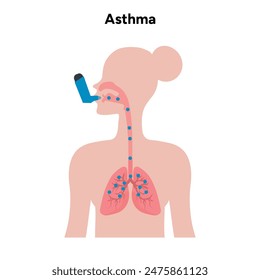 Asma pulmonar en el zoom humano