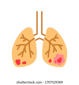 Lungs cancer line color icon. Human organ concept. Malignant neoplasm. Sign for web page, mobile app, button, logo. isolated element. Editable stroke