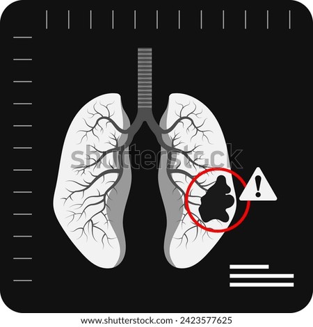Lungs damaged x ray icon, concept flat style. Internal organs of the human design element, logo. Anatomy, medicine concept. Healthcare vector illustration