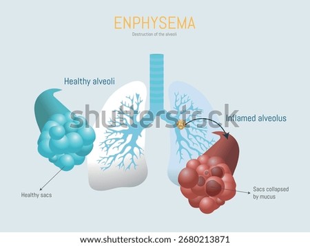 Lungs diagram illustrating emphysema, comparing healthy alveoli with inflamed, collapsed sacs damaged by mucus buildup, showcasing this chronic respiratory condition
