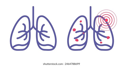 Pulmones sanos y enfermos icono línea de Vector contorno trazo arte gráfico conjunto de ilustración, Vector de neumonía Imagen lineal Clip arte recortado 
