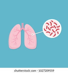 Lungs Of Infected Person. Mycobacterium Tuberculosis Close-up. Tuberculosis Bacteria Danger