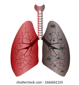 Lungs infections icon. Internal organs of the human design element, logo. Anatomy, lung organ on white background.