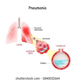 665 Structure alveolus Images, Stock Photos & Vectors | Shutterstock