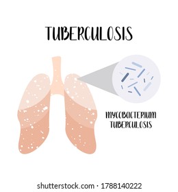 Lungs with Mycobacterium tuberculosis.  Pulmonology. Vector flat cartoon illustration. Perfect for banner, medical brochure, flyer