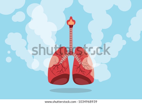 Lungs On Smoke Unhealthy Sign Flat Stock Vector (Royalty Free ...