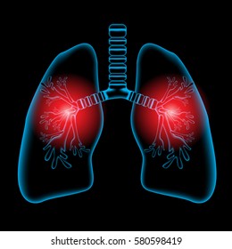 Lungs pain, Lungs x ray